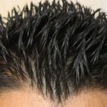 Il gel fa cadere i capelli?