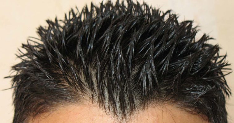 Il gel fa cadere i capelli?