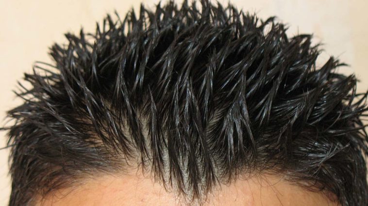 Il gel fa cadere i capelli?