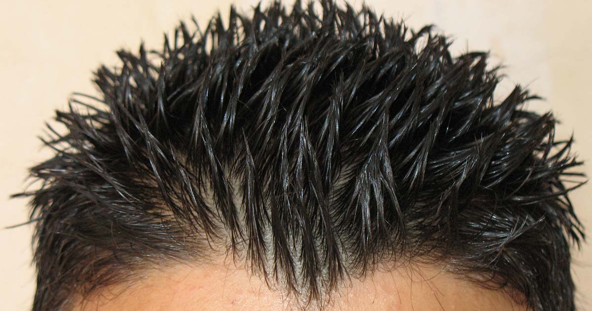 Il gel fa cadere i capelli?