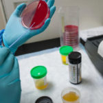 Colore della pipì in test di laboratorio medici esami delle urine