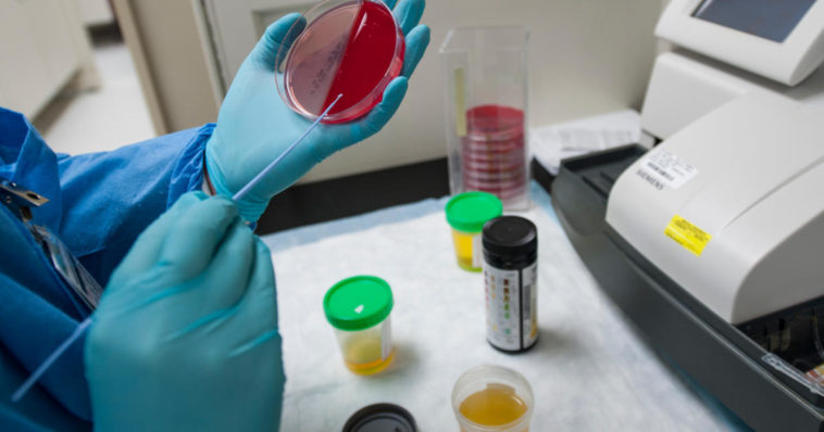 Colore della pipì in test di laboratorio medici esami delle urine