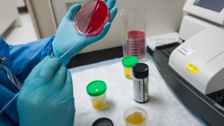 Colore della pipì in test di laboratorio medici esami delle urine